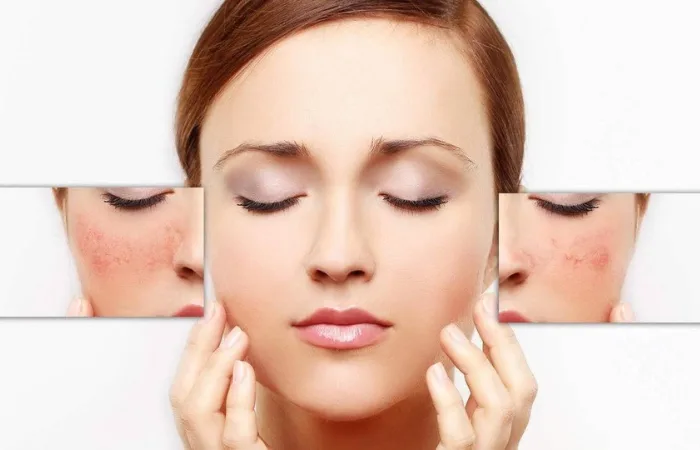 kem chong nang cho da kich ung png