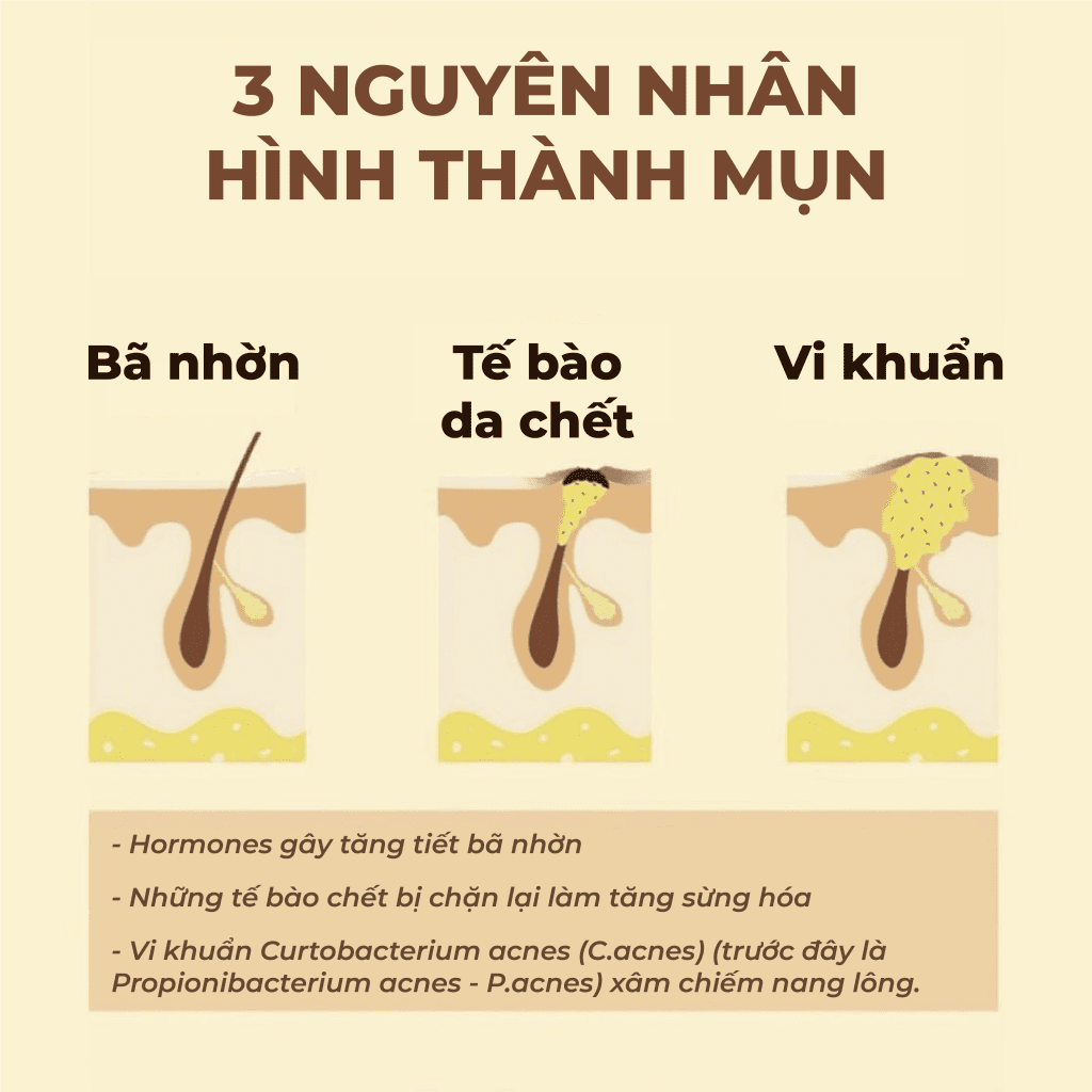 4179607 02 c59bf1c4ca