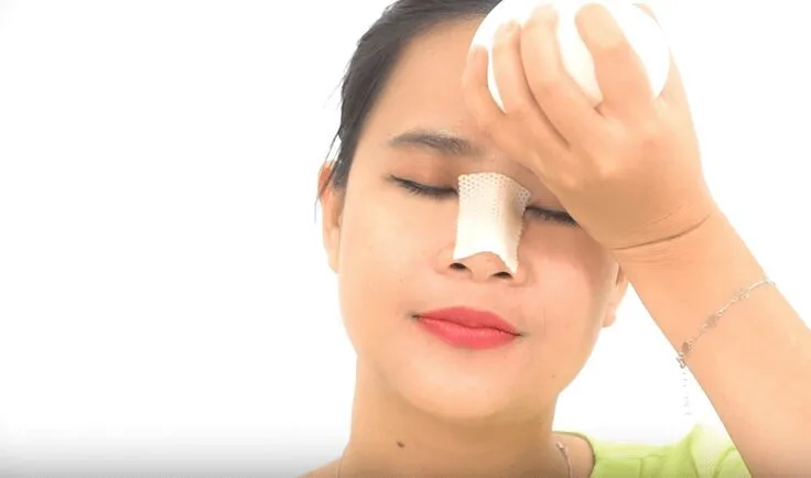 20210210 091832 844155 nang mui.max 800x800 1