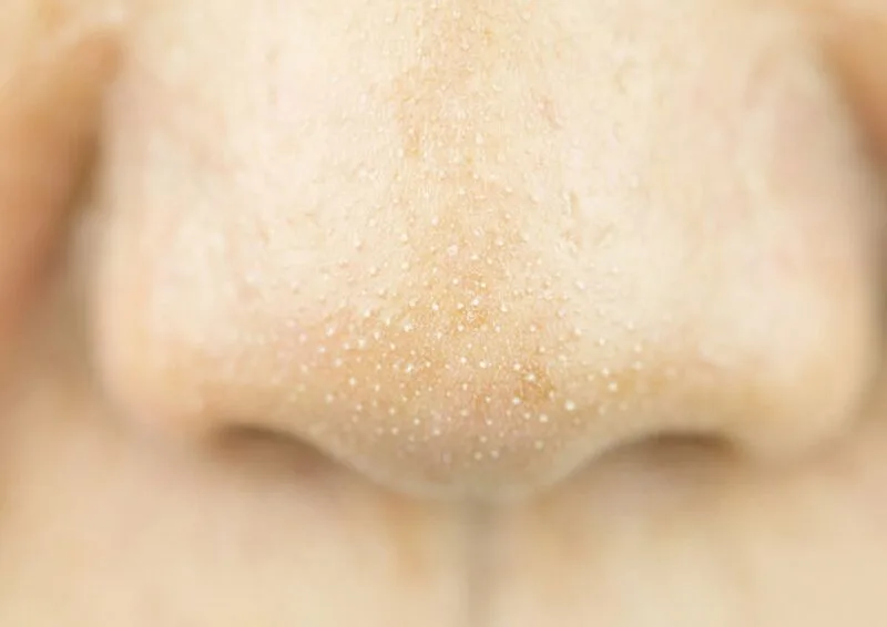 20210308 042019 681240 nan mun cam o mui.max 800x800 1