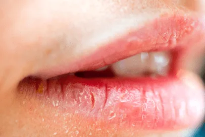 20210418 132619 129406 moi nut ne 1.max 800x800 1 png