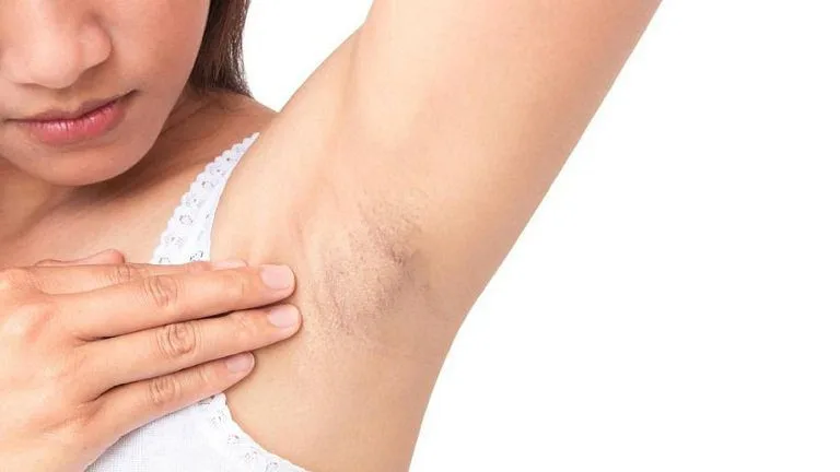 20210524 045006 231284 ngua nach khi dung la.max 800x800 1