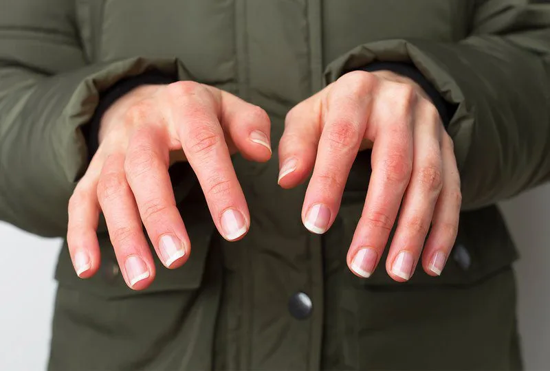 20210524 093956 718422 bong lanh.max 800x800 1