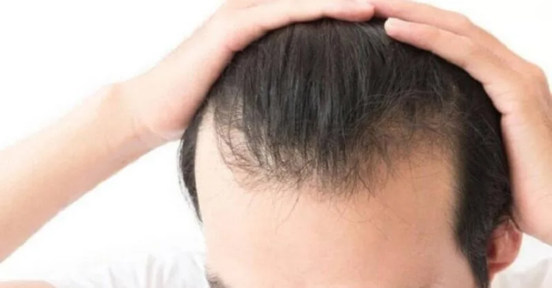 20210614 005822 446870 rung toc nhieu o nam.max 800x800 1