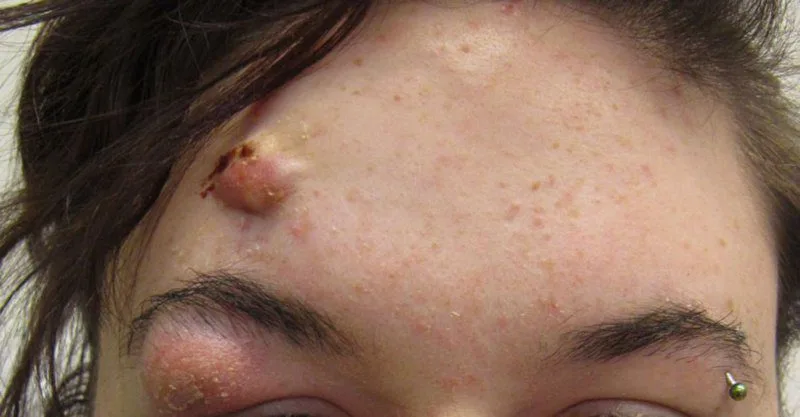 20210615 152005 538121 mun boc o tran.max 800x800 1