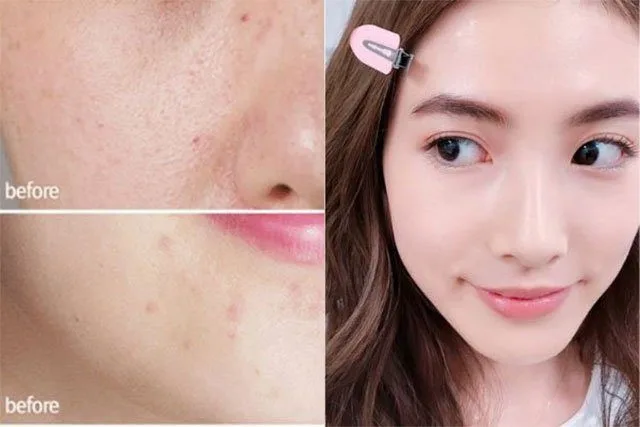 20210617 042355 520772 che khuyet diem.max 800x800 1