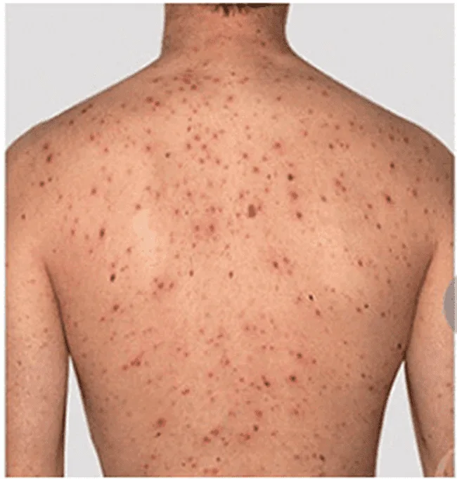 20210617 084802 442912 viem nang long 2.max 800x800 1 png