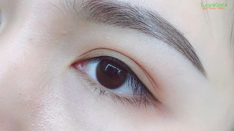 20210625 020719 978464 phun mi mat.max 800x800 1