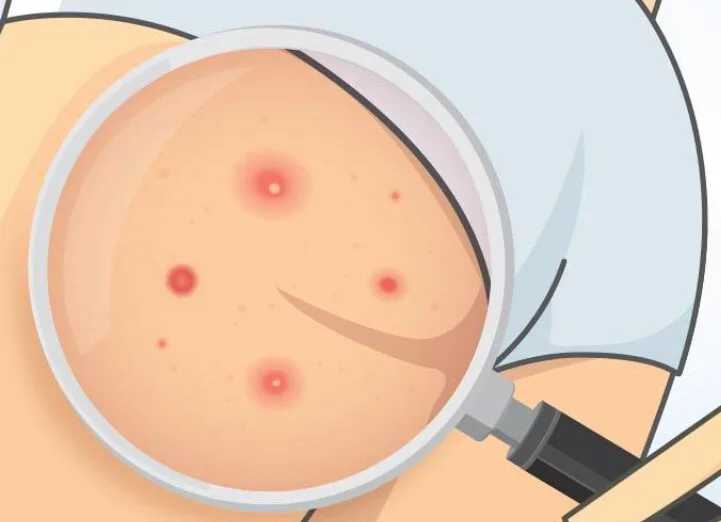 20211205 142934 444737 noi mun nhieu.max 800x800 1