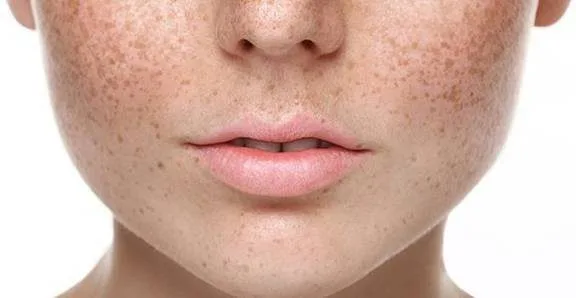 20220130 204738 062554 nguyen nhan gay nam d.max 800x800 1