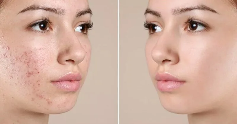 20220730 115111 107540 1 1640849592877173049.max 800x800 1