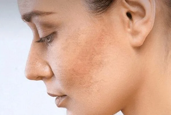 20220730 115522 019491 dung retinol bi sam d.max 800x800 1