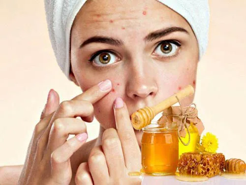 20221108 070040 845947 cach tri mun bang mat.max 800x800 1