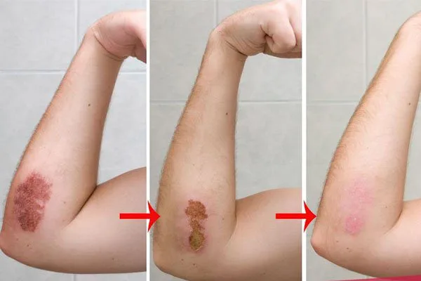 20221128 042504 833156 Cac giai doan lam lan.max 800x800 1