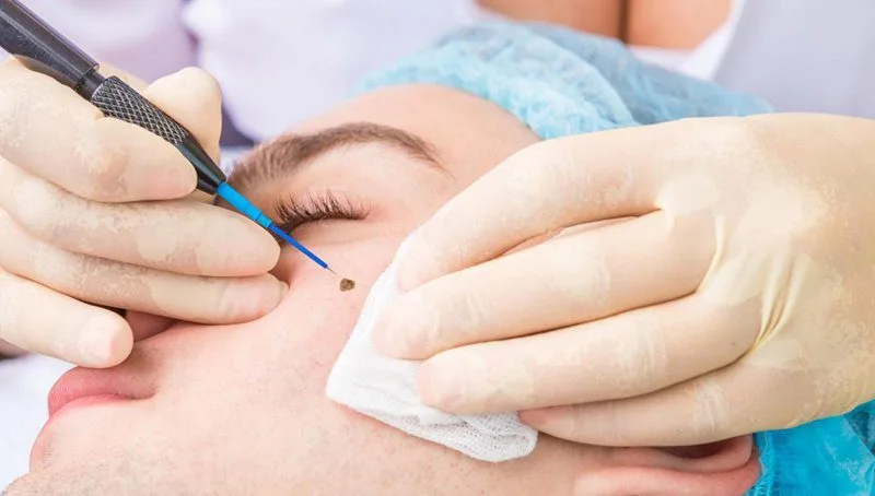 20221207 080645 110392 boi thuoc gi sau khi .max 800x800 1