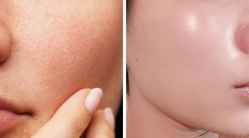 20230112 082444 694630 chat lam se khit u.max 800x800 1