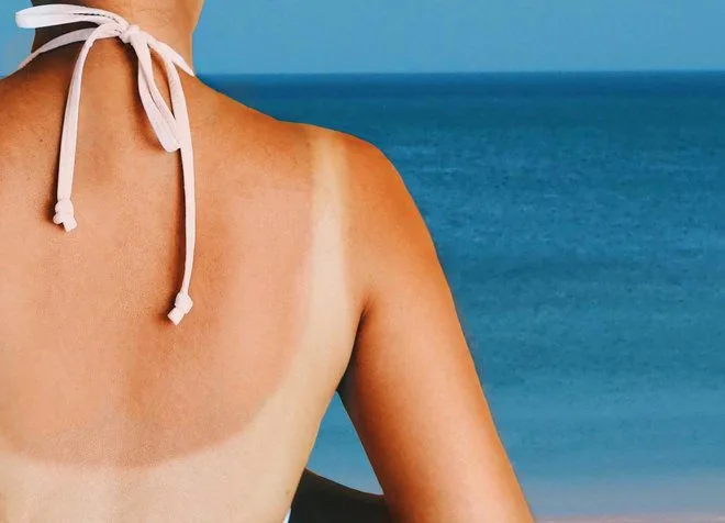 20230126 025151 169946 tac hai cua chay nang.max 800x800 1