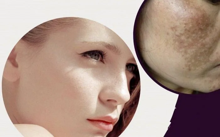 20230310 045458 505574 serum 1 9648.max 800x800 1