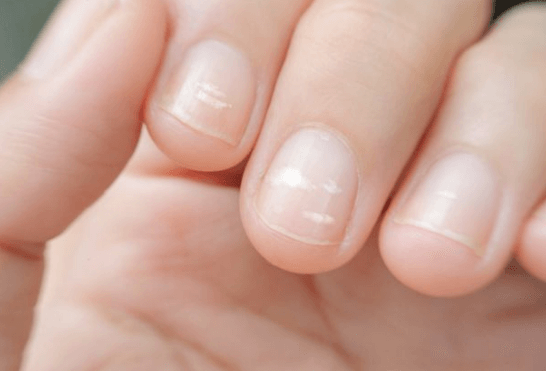 thiếu chất sắt