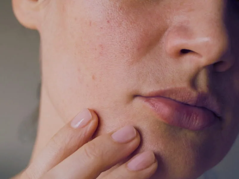 dry vs dehydrated skin top tips gamila secret uid 61ba0bb539416