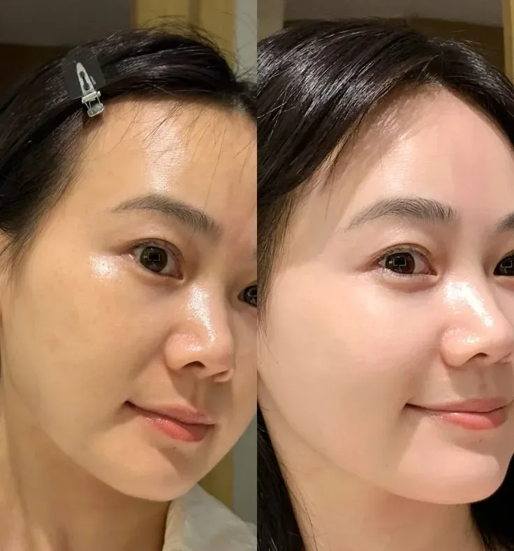 08b9227071aa4ee06017f7a8ad032a93 e1751013720446