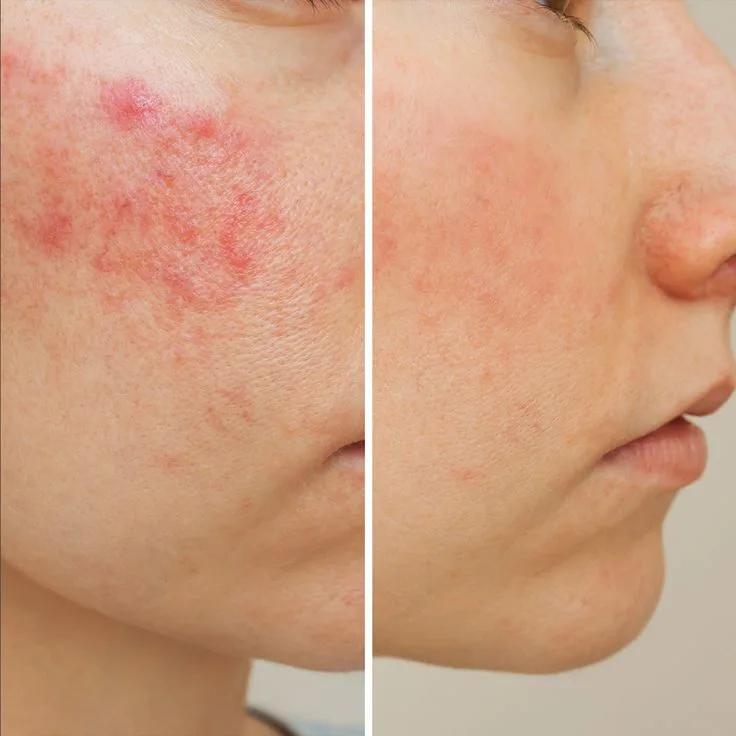 3f3de37566ebebd1ca816d3d6106941b