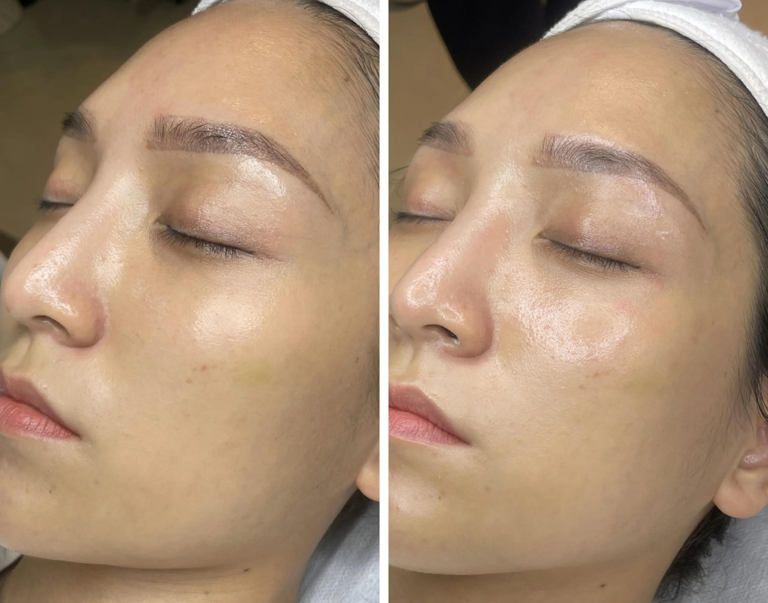 Cap am cang bong da sau 1 lan 2