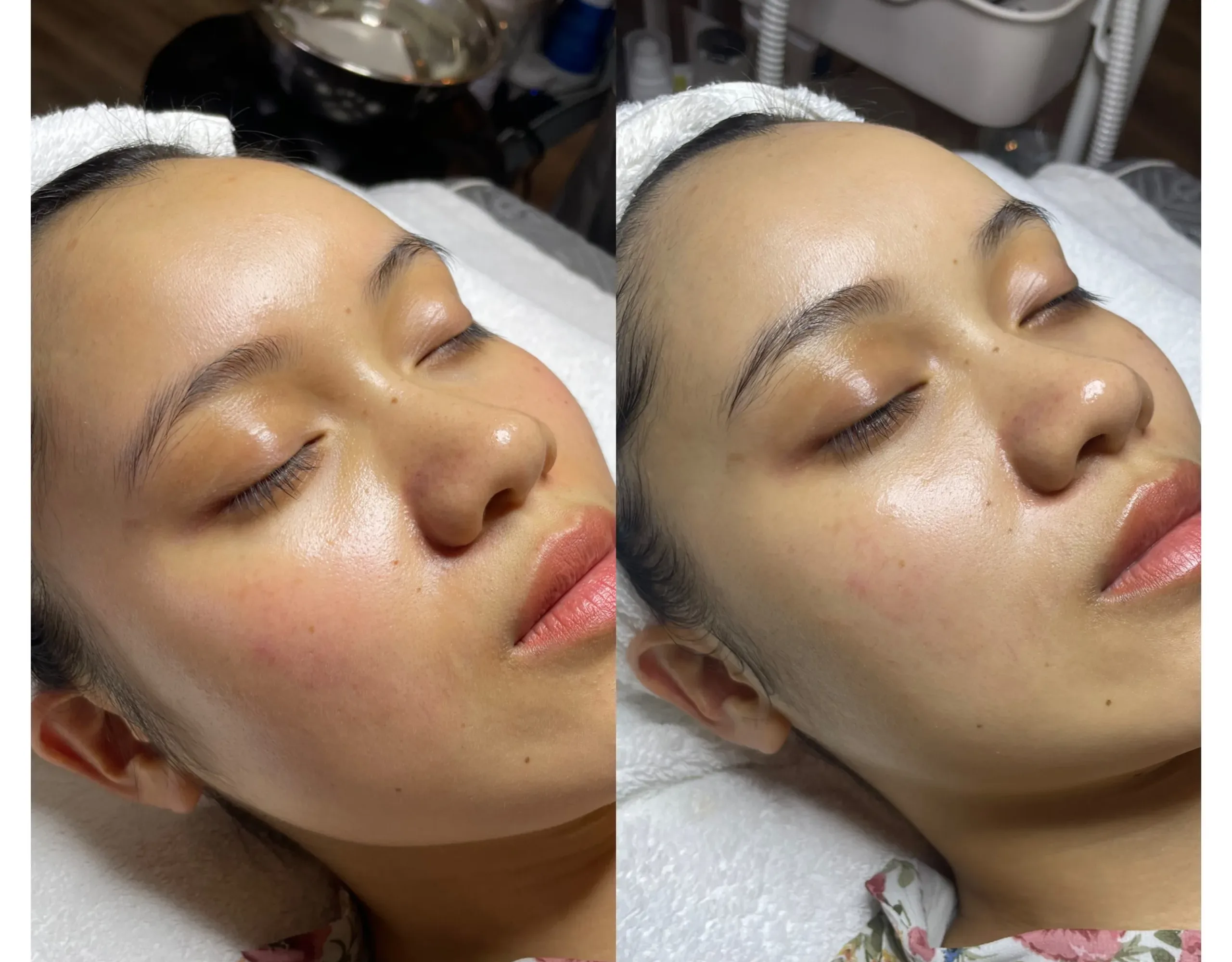 Cap am chuyen sau sau 1 lan e1751254500672