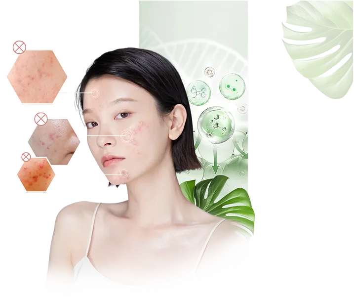 LT12 ANTI OIL ACNE face 2 png