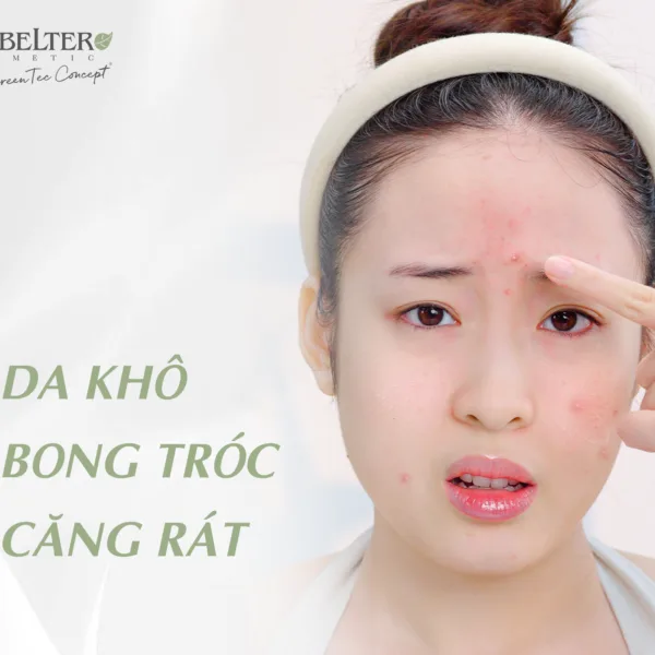 anh 1
